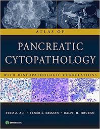 Atlas of Pancreatic Cytopathology with Histopathologic Correlations First Edition PDF