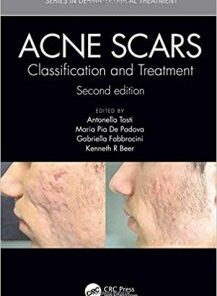 Acne Scars: Classification and Treatment, 2nd Edition PDF