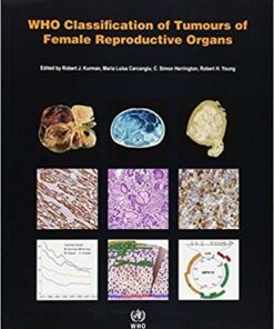 WHO Classification of Tumours of the Female Reproductive Organs (IARC WHO Classification of Tumours)