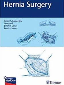 Hernia Surgery PDF