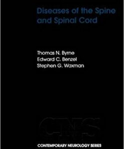 Diseases of the Spine and Spinal Cord (Contemporary Neurology Series) by Thomas N. Byrne (2000-01-13) PDF