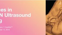 Advances in OB/GYN Ultrasound Imaging 2018