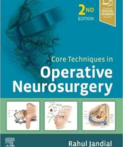 Core Techniques in Operative Neurosurgery 2nd Edition PDF & Video