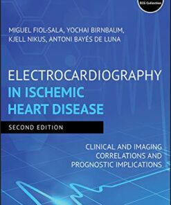 Electrocardiography in Ischemic Heart Disease: Clinical and Imaging Correlations and Prognostic Implications PDF