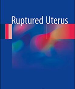 Ruptured Uterus 1st ed. 2017 Edition