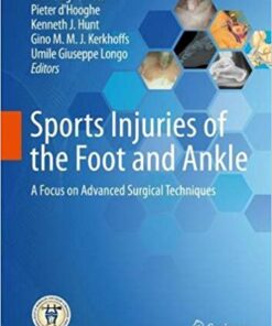 Sports Injuries of the Foot and Ankle: A Focus on Advanced Surgical Techniques 1st ed. 2019 Edition PDF