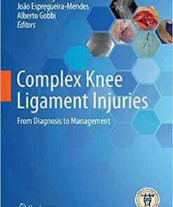 Complex Knee Ligament Injuries: From Diagnosis to Management 1st ed. 2019 Edition PDF