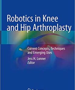 Robotics in Knee and Hip Arthroplasty: Current Concepts, Techniques and Emerging Uses 1st ed. 2019 Edition PDF