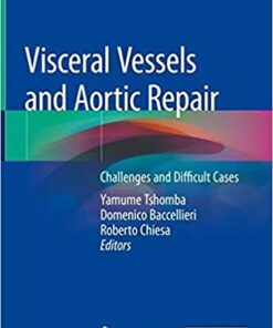 Visceral Vessels and Aortic Repair: Challenges and Difficult Cases 1st ed. 2019 Edition PDF