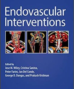Endovascular Interventions 1st Edition PDF