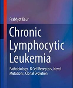 Chronic Lymphocytic Leukemia: Pathobiology, B Cell Receptors, Novel Mutations, Clonal Evolution (Molecular and Translational Medicine) 1st ed. 2018 Edition PDF