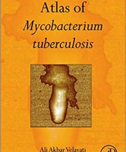 Atlas of Mycobacterium Tuberculosis 1st Edition PDF