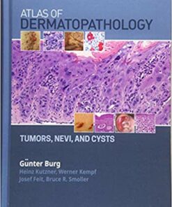 Atlas of Dermatopathology: Tumors, Nevi, and Cysts 1st Edition PDF