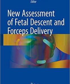 New Assessment of Fetal Descent and Forceps Delivery 1st ed. 2018 Edition PDF