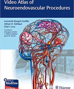 Video Atlas of Neuroendovascular Procedures 1st Edition PDF & VIDEO