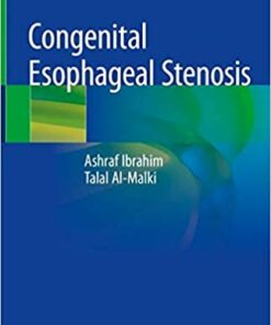 Congenital Esophageal Stenosis 2019 PDF