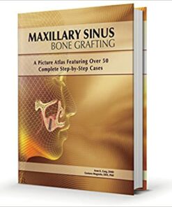 Maxillary Sinus Bone Grafting: A Picture Atlas Featuring over 50 Complete Step-By-Step Cases PDF