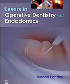 Laser in Operative Dentistry 1st Edition PDF