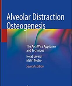 Alveolar Distraction Osteogenesis: The ArchWise Appliance and Technique 2nd ed. 2020 Edition PDF