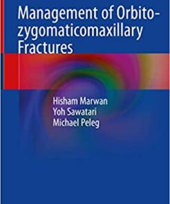 Management of Orbito-zygomaticomaxillary Fractures 1st ed. 2020 Edition PDF