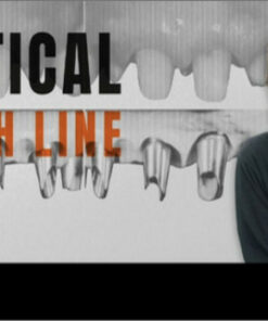 Vertical Finish Line - Fabio Scutella