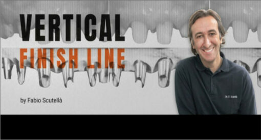 Vertical Finish Line - Fabio Scutella