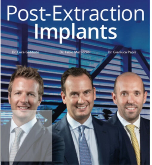 Post-Extraction Implants (Video course)