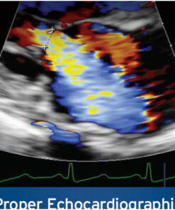 ASE: Proper Echocardiographic Measurements: How & Why 2nd Edition