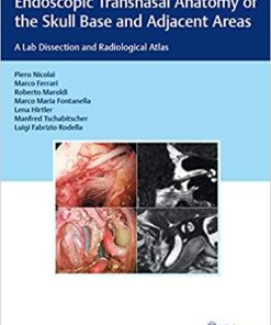 Endoscopic Transnasal Anatomy of the Skull Base and Adjacent Areas: A Lab Dissection and Radiological Atlas 1st Edition PDF