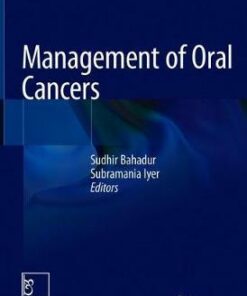 Management of Oral Cancers PDF