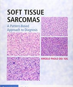 Soft Tissue Sarcomas Hardback with Online Resource 1st Edition PDF