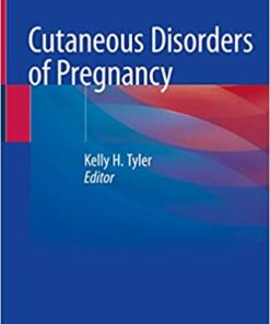 Cutaneous Disorders of Pregnancy 1st ed. 2020 Edition PDF