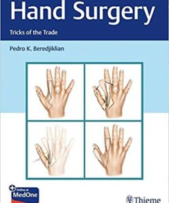 Hand Surgery (Tricks of the Trade) 1st Edition PDF