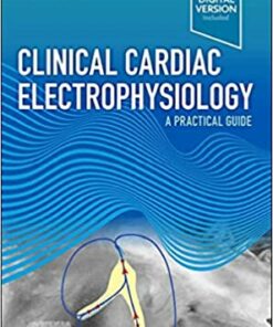 Clinical Cardiac Electrophysiology: A Practical Guide 1st Edition PDF