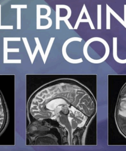Adult Brain MRI Review Course – Online
