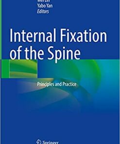 Internal Fixation of the Spine: Principles and Practice 1st ed. 2021 Edition PDF