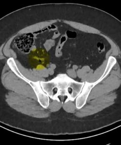 MRIOnline Imaging Mastery Series: Appendix 2021