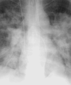 Imaging Mastery Series: Cardiopulmonary Imaging 2021