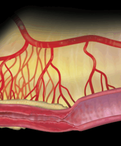 Imaging Mastery Series: Crohn's Disease 2021