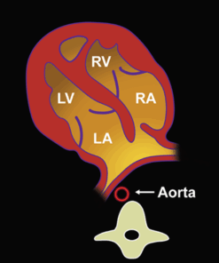 Imaging Mastery Series: Fetal Heart and Great Vessel Evaluation 2021