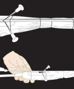 Imaging Mastery Series: Image-Guided Abscess Drainage in Interventional Radiology 2021