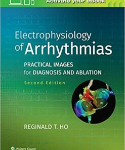 Electrophysiology of Arrhythmias: Practical Images for Diagnosis and Ablation 2nd Edition PDF