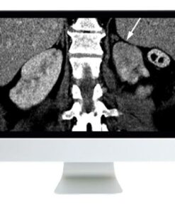 ARRS Abdominal and Thoracic Imaging Guidelines Applied: Evidence Versus Opinion 2021