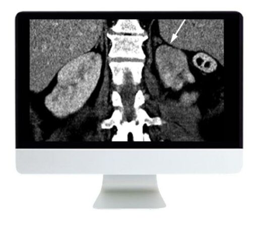 ARRS Abdominal and Thoracic Imaging Guidelines Applied: Evidence Versus Opinion 2021