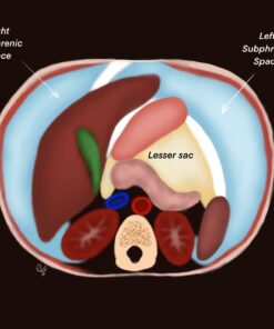 Imaging Mastery Series: Peritoneum and Mesentery 2021