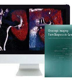 ARRS Oncologic Imaging: From Diagnosis to Cure 2016