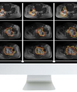 Crossroads of Computational Science and Musculoskeletal Imaging: Where Machine Magic Can Aid Radiologists 2021