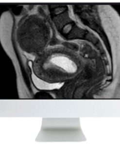 ARRS Abdominal MRI: Practical Applications and Advanced Imaging Techniques 2021