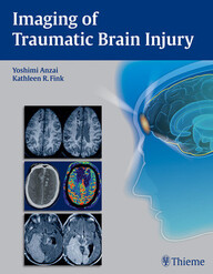 Imaging of Traumatic Brain Injury 1st Edition PDF