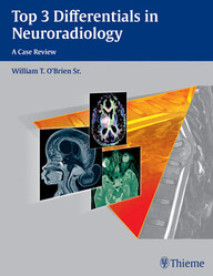 Top 3 Differentials in Neuroradiology 1st Edition PDF